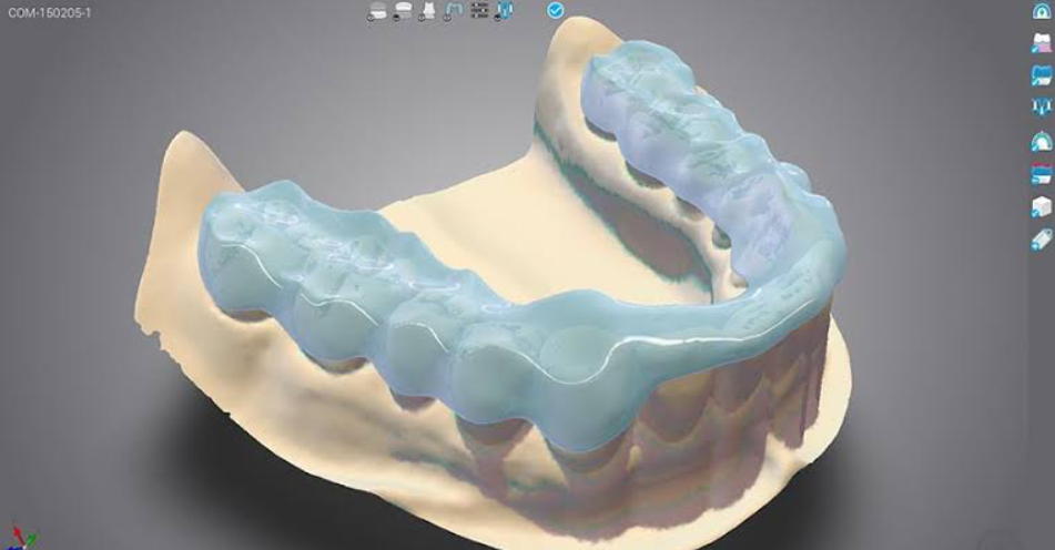 Dental Wings DWOS
